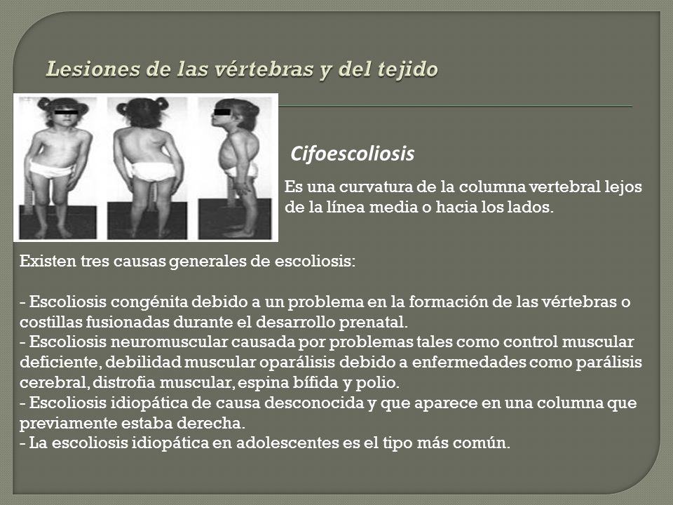 El tratamiento de la curvatura de la columna vertebral omsk